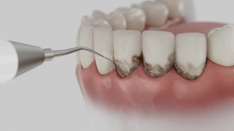 Reliable Dental Implants contractor in Utica, OH by Smile Center Dentistry